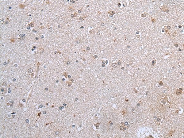 Polyclonal Rabbit anti-Human CLDN12 / Claudin 12 Antibody (IHC)