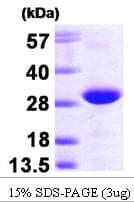 Human TC21 / RRAS2 Protein (Recombinant His)