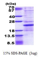 Human NHLH1 / HEN1 Protein (Recombinant His)