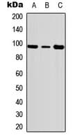 Polyclonal Rabbit anti-Human FER Antibody (phospho-Tyr402, IHC, WB)