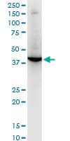 Monoclonal Mouse anti-Human RNF2 / RING2 / RING1B Antibody (clone 4A9, WB)