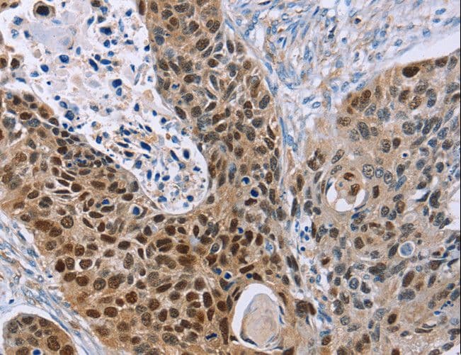 MAGE10 / MAGEA10 Antibody