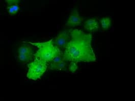 PAICS / ADE2 Antibody (clone OTI2C9)