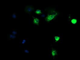 Monoclonal Mouse anti-Human DEF6 Antibody (clone OTI1E3, IHC, IF, WB)