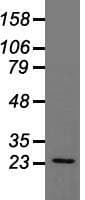 TNNI3 / Cardiac Troponin I Antibody (clone OTI4E5)