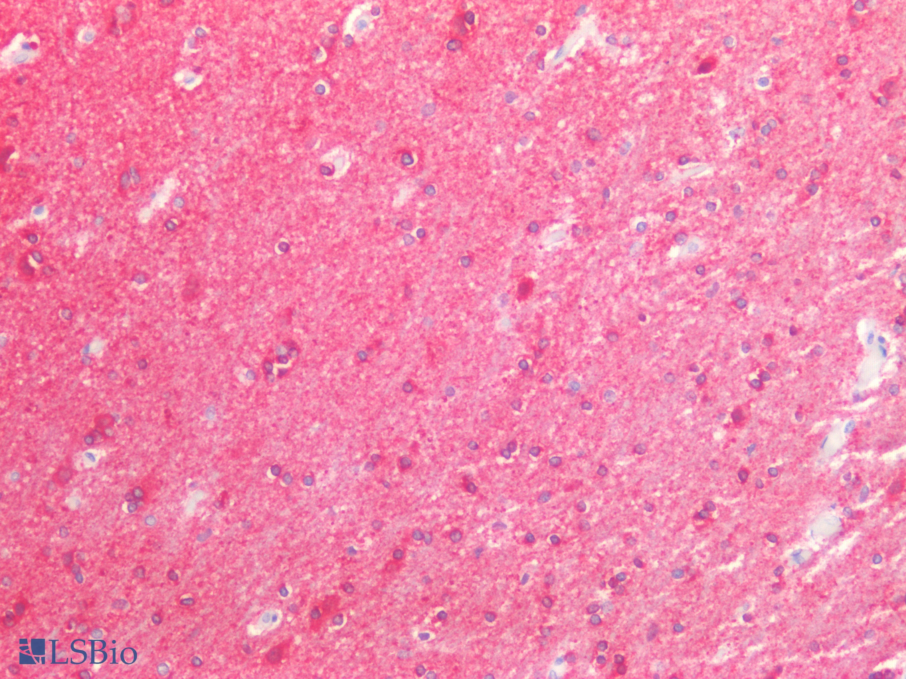 MAPT / Tau Antibody (C-Terminus)