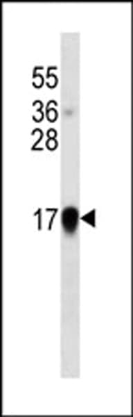 IFNA1 / Interferon Alpha 1 Antibody