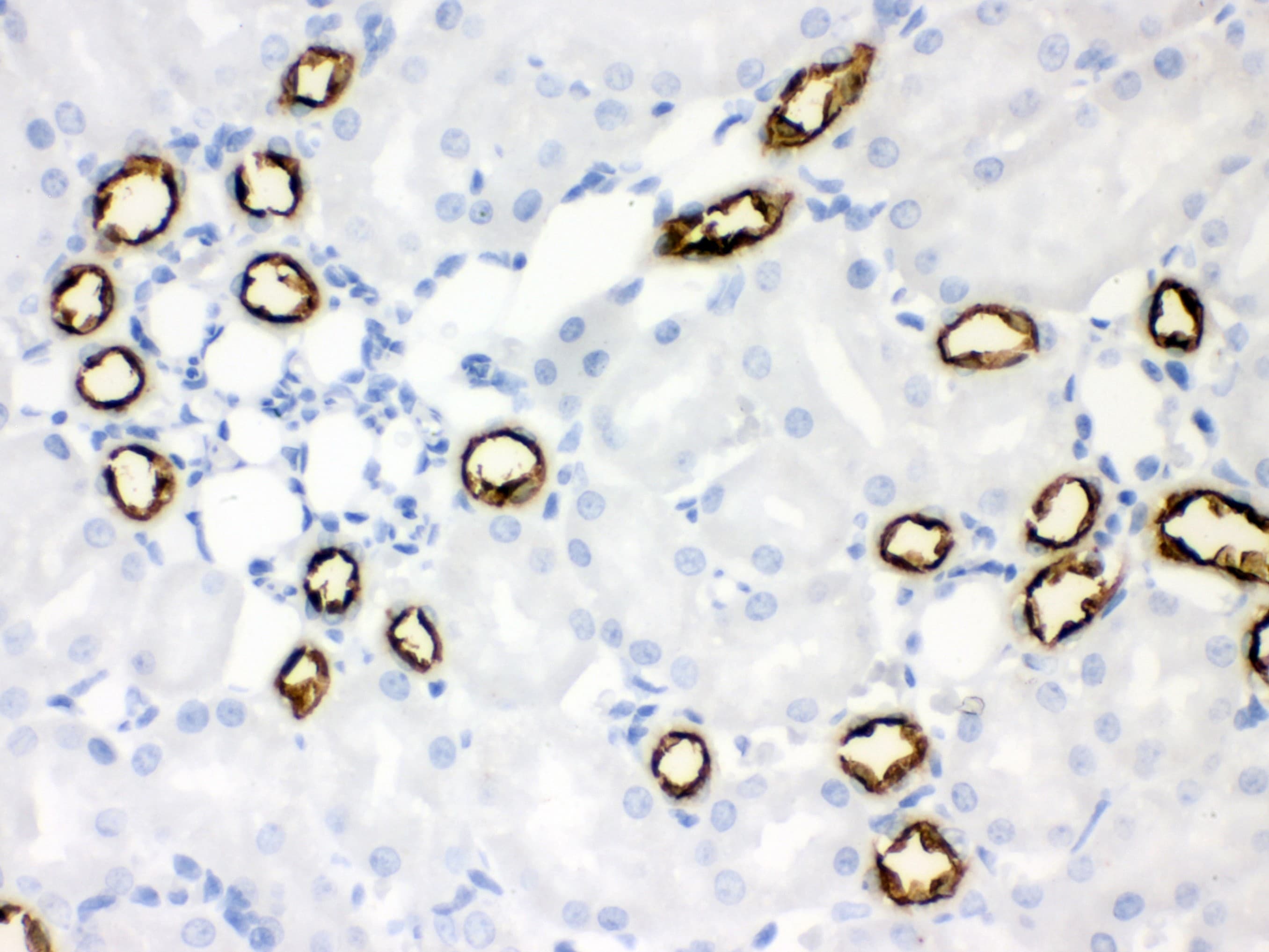 Polyclonal Rabbit anti-Human SLC12A1 / NKCC2 Antibody (aa52-83, IHC, WB)