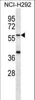 Polyclonal Rabbit anti-Human MATN1 / Matrilin 1 Antibody (aa376-405, IHC, WB)