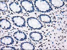 PLK1 / PLK-1 Antibody (clone OTI5C1)