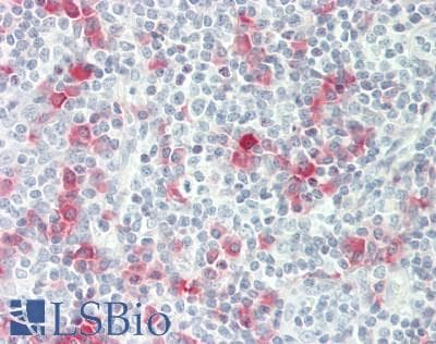 Polyclonal Rabbit anti-Human AICDA / AID Antibody (IHC)
