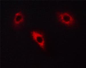 DPYSL2 / CRMP2 Antibody (phospho-Thr514)