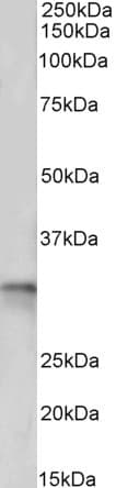 IHC-plus™ TPM4 Antibody (aa266-276)