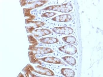Monoclonal Mouse anti-Human CTNNB1 / Beta Catenin Antibody (clone CTNNB1/1508, IHC, IF, WB)