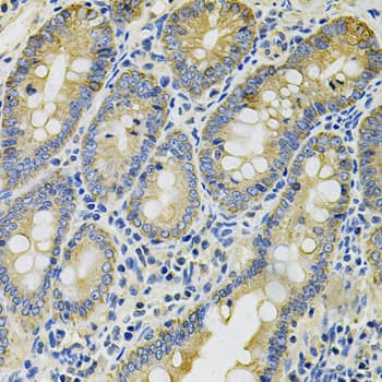 KRT20 / CK20 / Cytokeratin 20 Antibody