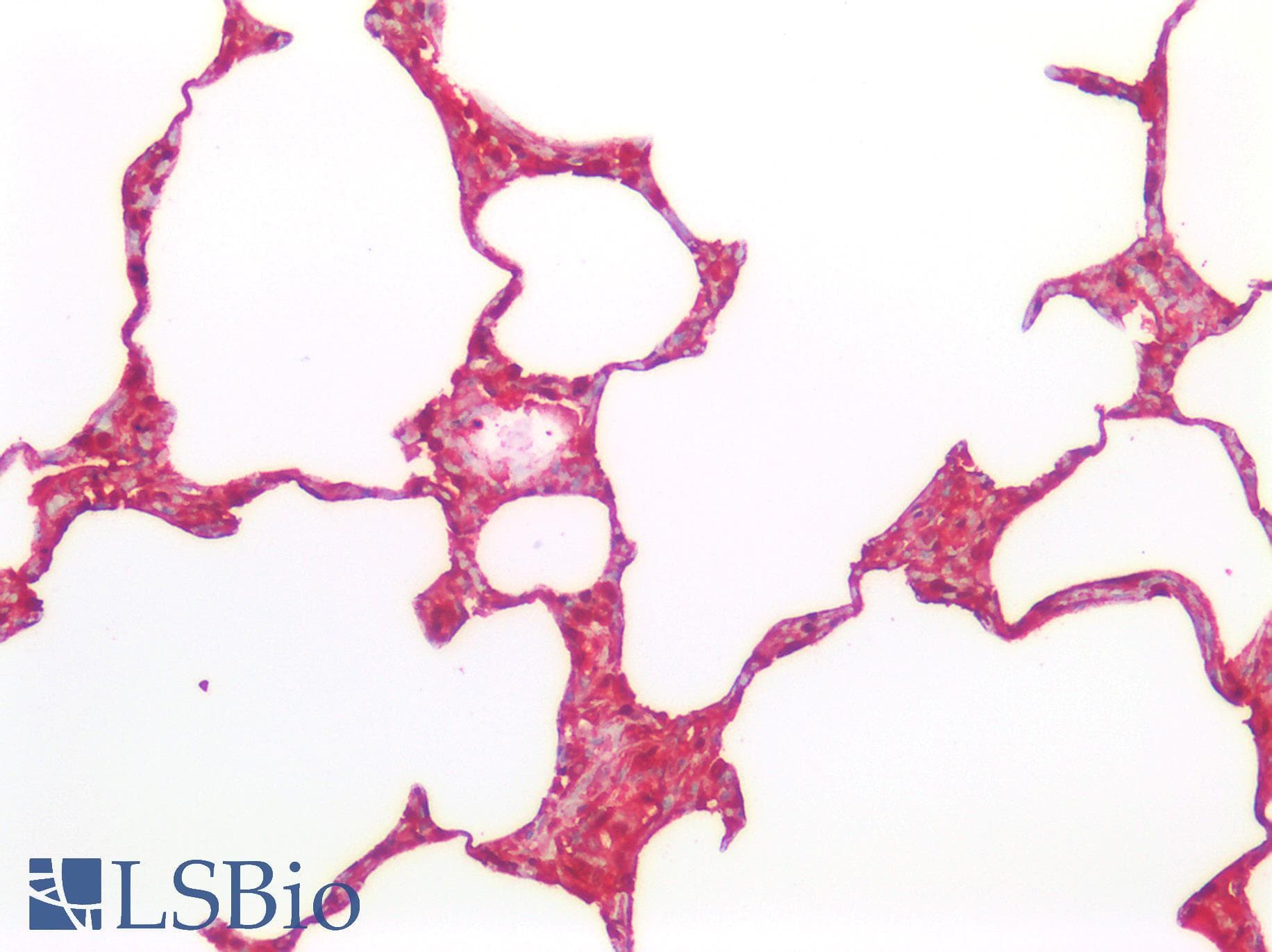 S100A6 / Calcyclin Antibody (aa1-89)