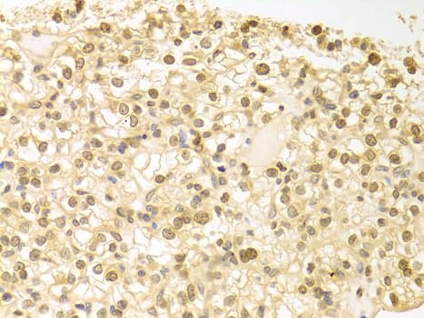 PLCB1 / Phospholipase C Beta 1 Antibody