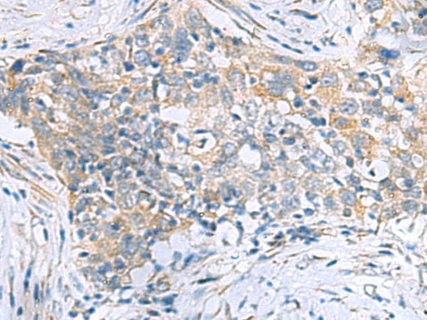 PPIC / Cyclophilin C Antibody