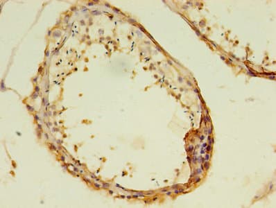 MAS1 / MAS Antibody (aa285-352)