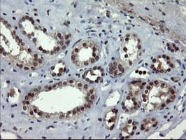 DOK7 Antibody (clone OTI7E2)