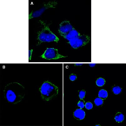 IHC-plus™ RTN3 / Reticulon 3 Antibody (clone 1E+11)