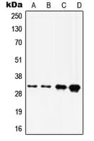 HOXD8 Antibody (C-Terminus)