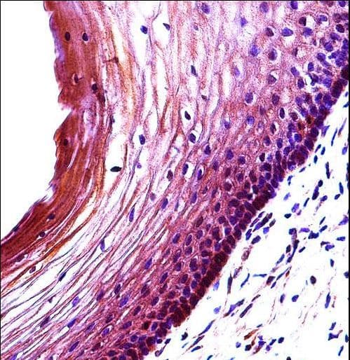 BBC3 / PUMA Antibody (aa109-137)
