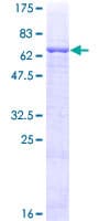 Human HPN / TMPRSS1 / Hepsin Protein (Recombinant GST)