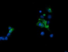 TAPBPL / TAPBPR Antibody (clone OTI4H5)