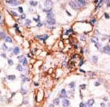 APOBEC3G / CEM15 Antibody (aa118-148)