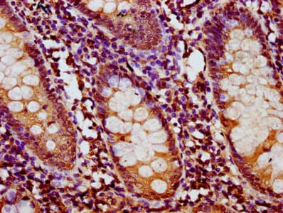 Polyclonal Rabbit anti-Human HT036 / HYI Antibody (IHC)