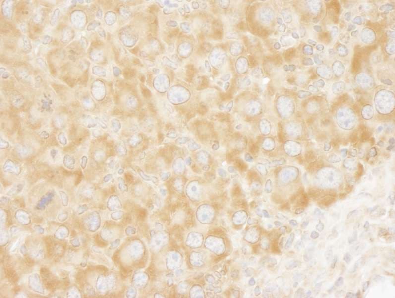 Polyclonal Rabbit anti-Human EIF3A Antibody (aa860-910, IHC)