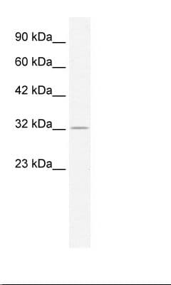Polyclonal Rabbit anti-Human ZFP36 / Tristetraprolin Antibody (aa84-133, IHC, WB)