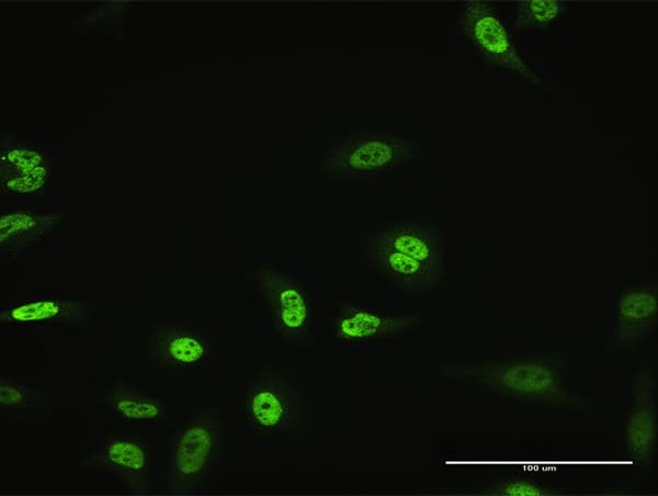 MZF / MZF1 Antibody (clone 1F7)