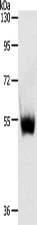 Polyclonal Rabbit anti-Human SLC30A6 Antibody (WB)