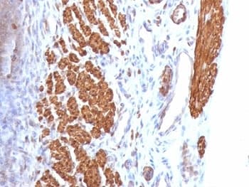 Calponin Antibody (clone CNN1/832)