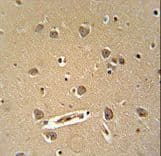 DENND5B Antibody (aa1066-1094)