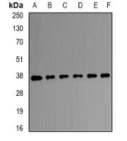 Polyclonal Rabbit anti-Human TALDO1 / Transaldolase 1 Antibody (IF, WB)
