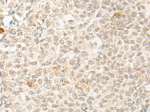 Polyclonal Rabbit anti-Human OTX1 Antibody (IHC)