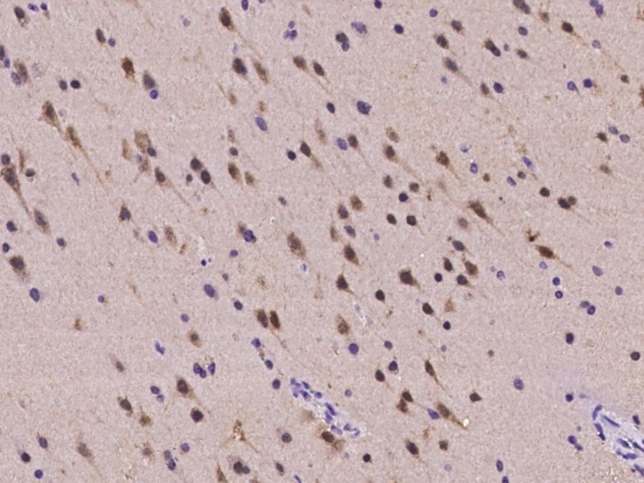 Polyclonal Rabbit anti-Human RBFOX1 / A2BP1 Antibody (IHC, IF)