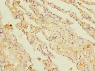 KCTD6 Antibody