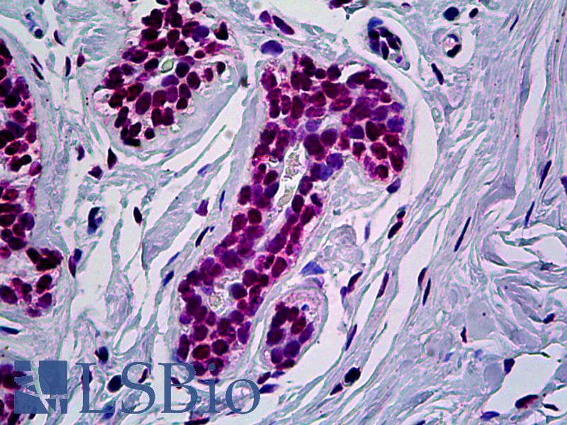 IHC-plus™ AML1 / RUNX1 Antibody (clone 3A8)