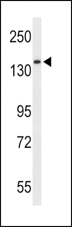 Polyclonal Rabbit anti-Human RECK Antibody (aa430-456, IHC, WB)