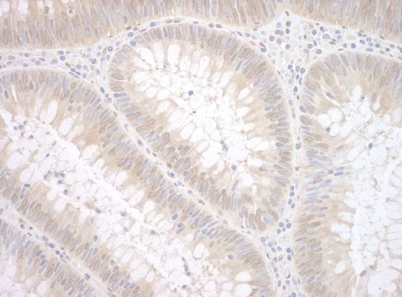 Polyclonal Rabbit anti-Human TDP2 / TTRAP Antibody (aa50-100, IHC, WB)