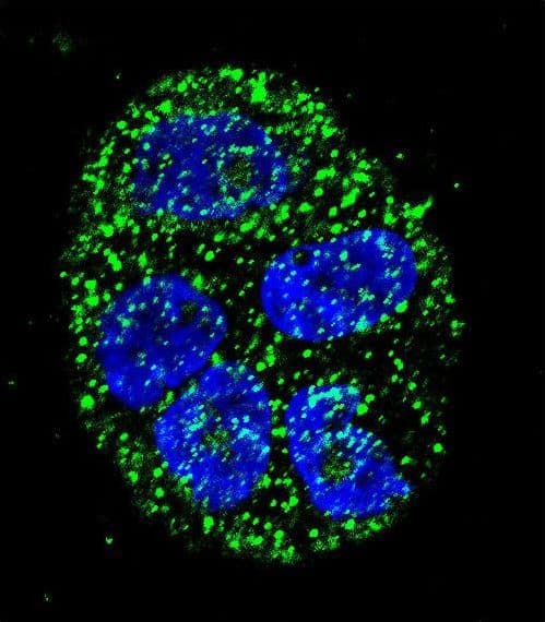 Polyclonal Rabbit anti-Human AGR2 Antibody (aa11-39, IHC, IF, WB)