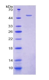 Human CYTH2 / Cytohesin 2 Protein (Recombinant His-T7)