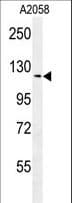Polyclonal Rabbit anti-Human NCKAP1 / NAP125 Antibody (aa631-659, WB)