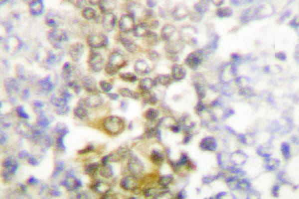 CSNK1A1 / CK1 Alpha Antibody (Phe158)