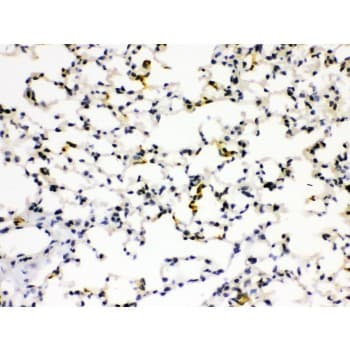 AGER / RAGE Antibody (aa91-120)