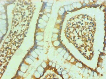 ENO2 / NSE Antibody (clone 4B1F5)